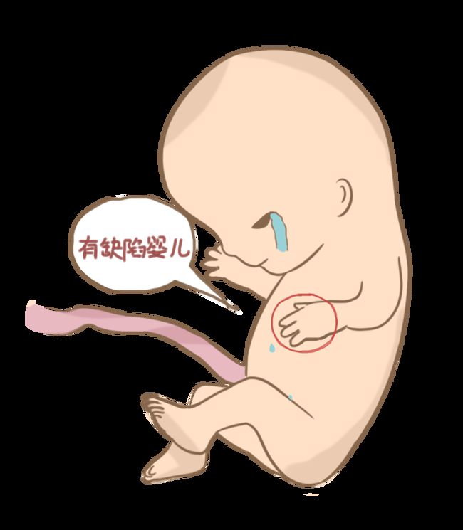 不育症