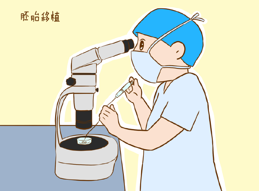 人流手术