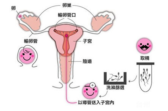 不育男人