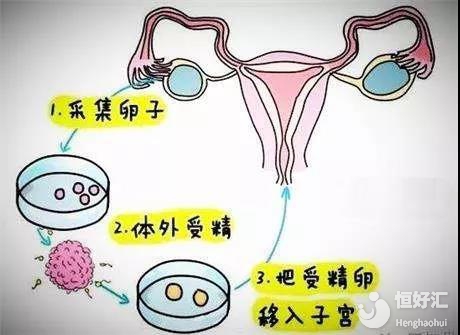避孕