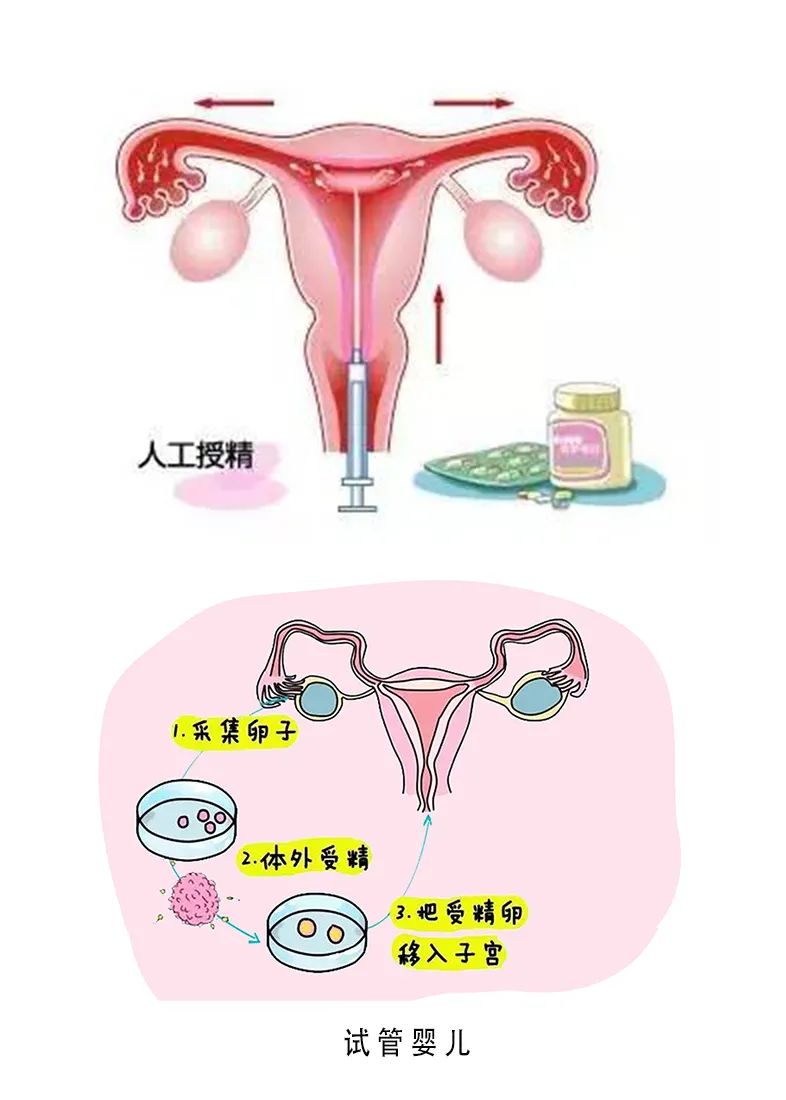 不孕不育专家医院