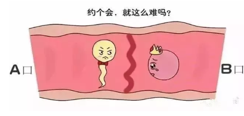 不孕不育