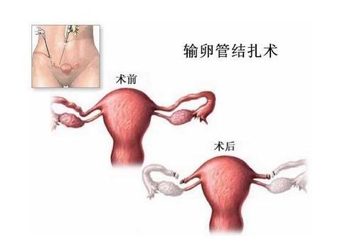 新手爸妈