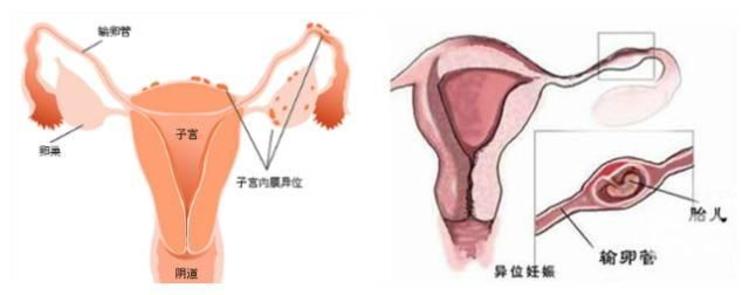 临沂三代试管婴儿