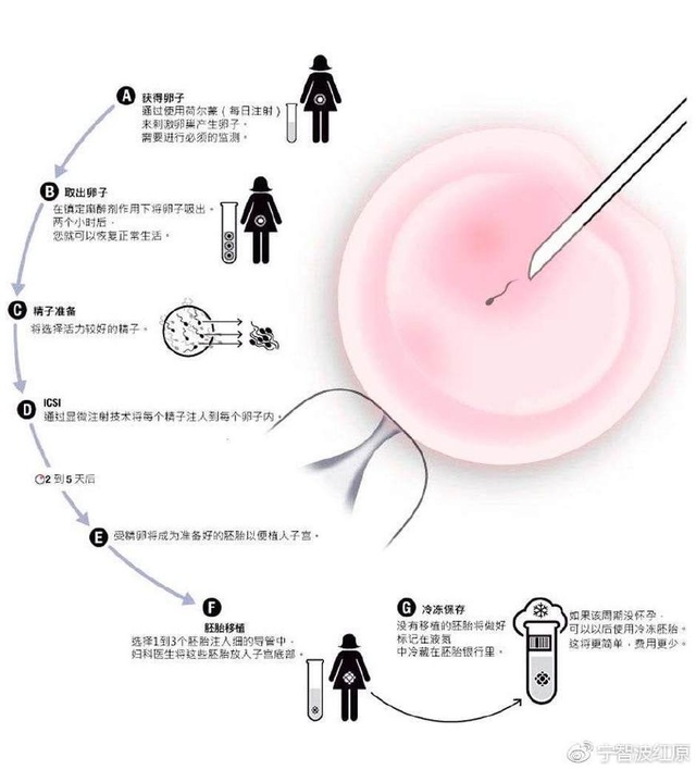 临沂三代试管婴儿