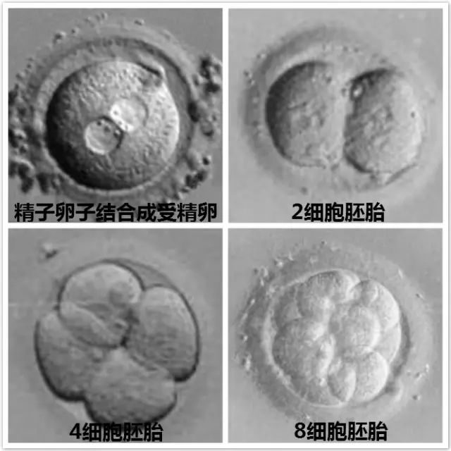 试管婴儿
