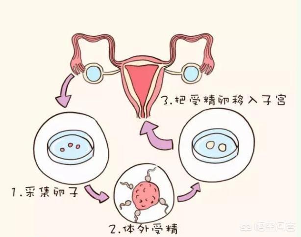 胚胎移植