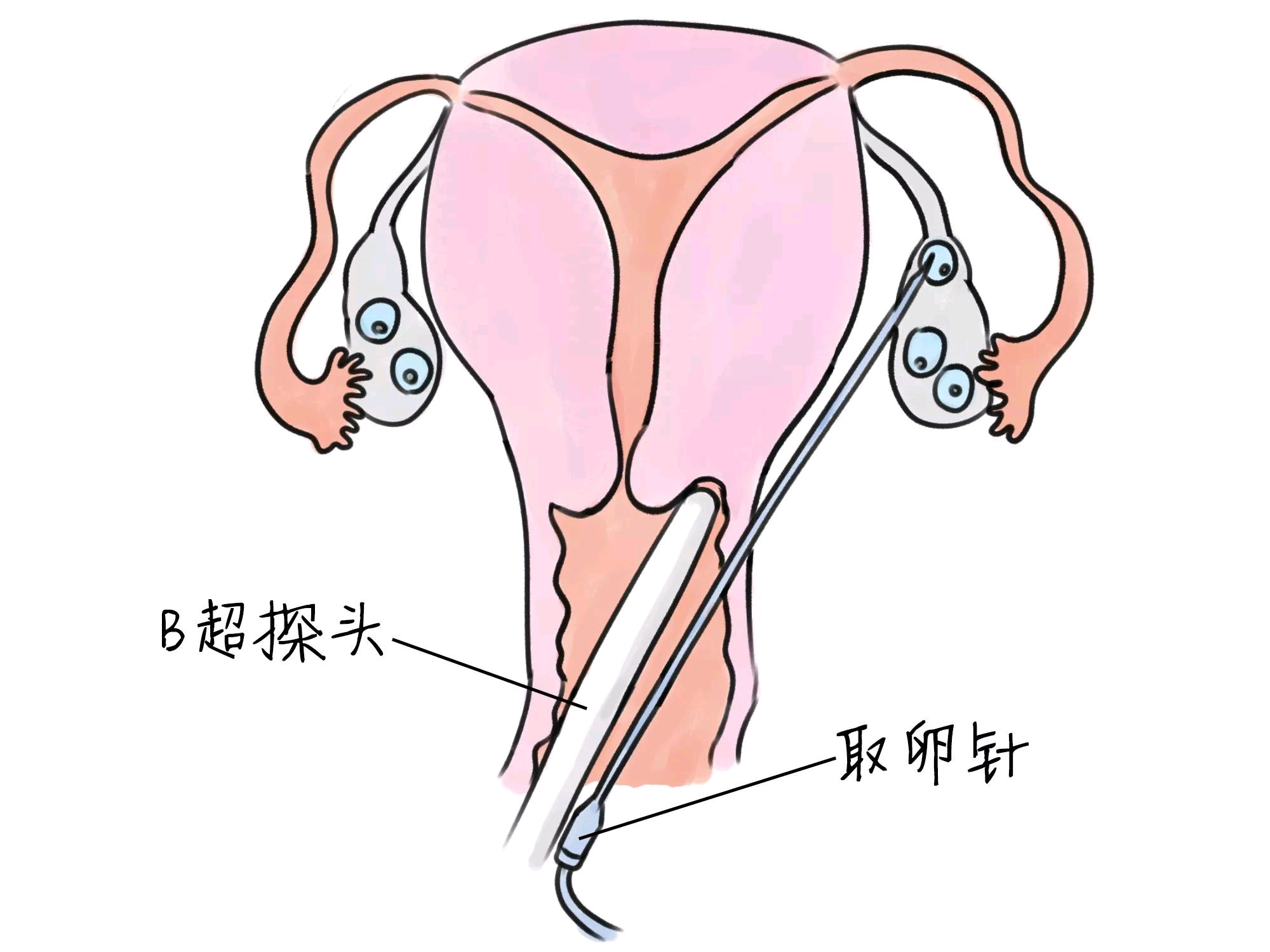 南阳捐卵费用