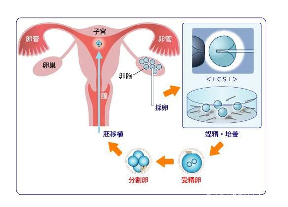 南宁试管代怀孕机构