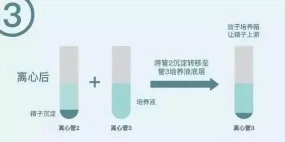 南昌捐赠精子