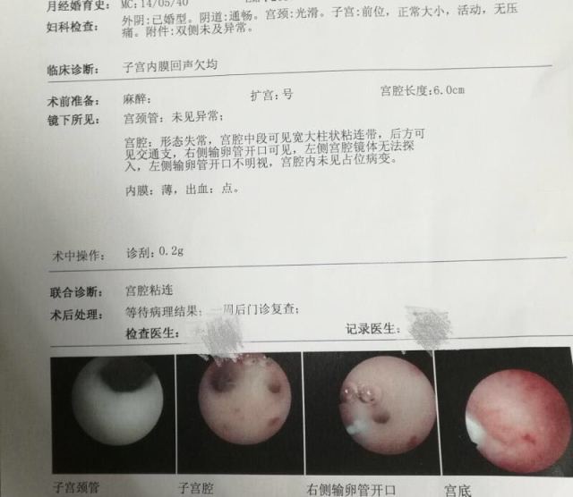 南昌捐卵公司