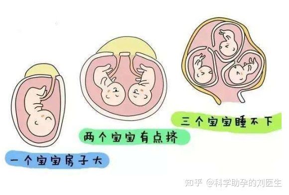 取卵手术